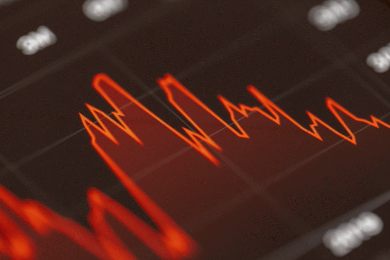 Treasury bonds